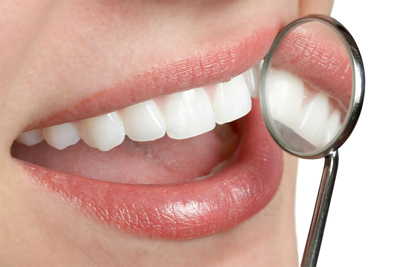 Dr. Evelyn Catuira Dental Offer