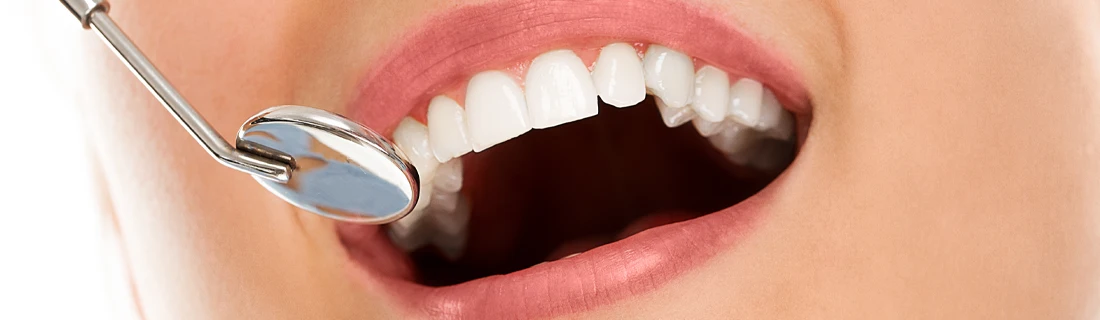 FC – Teeth Cleaning in Diamond Bar CA